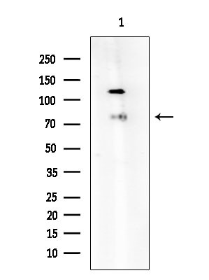 TCF4 Antibody in Western Blot (WB)