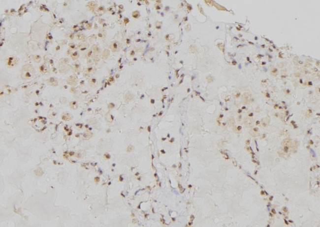 RRM1 Antibody in Immunohistochemistry (Paraffin) (IHC (P))