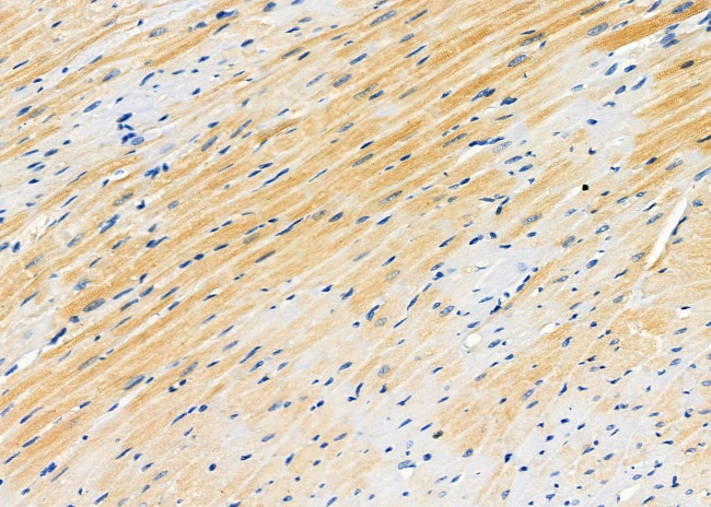 RRM1 Antibody in Immunohistochemistry (Paraffin) (IHC (P))