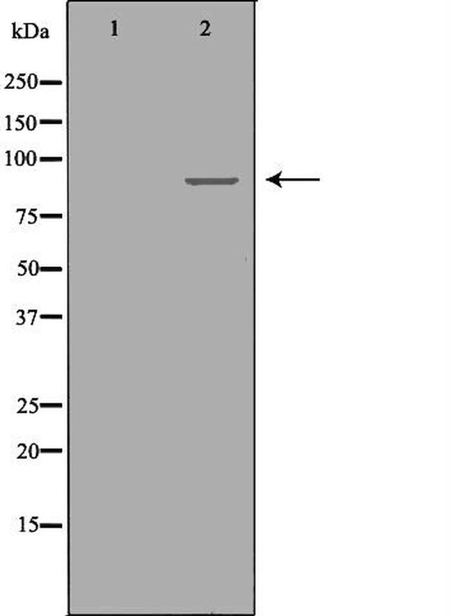 RRM1 Antibody in Western Blot (WB)