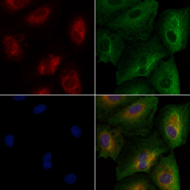 FAAH Antibody in Immunocytochemistry (ICC/IF)