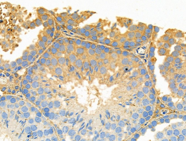 FAAH Antibody in Immunohistochemistry (Paraffin) (IHC (P))