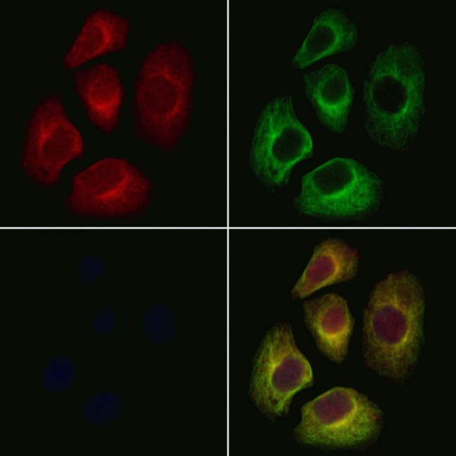 GGA2 Antibody in Immunocytochemistry (ICC/IF)