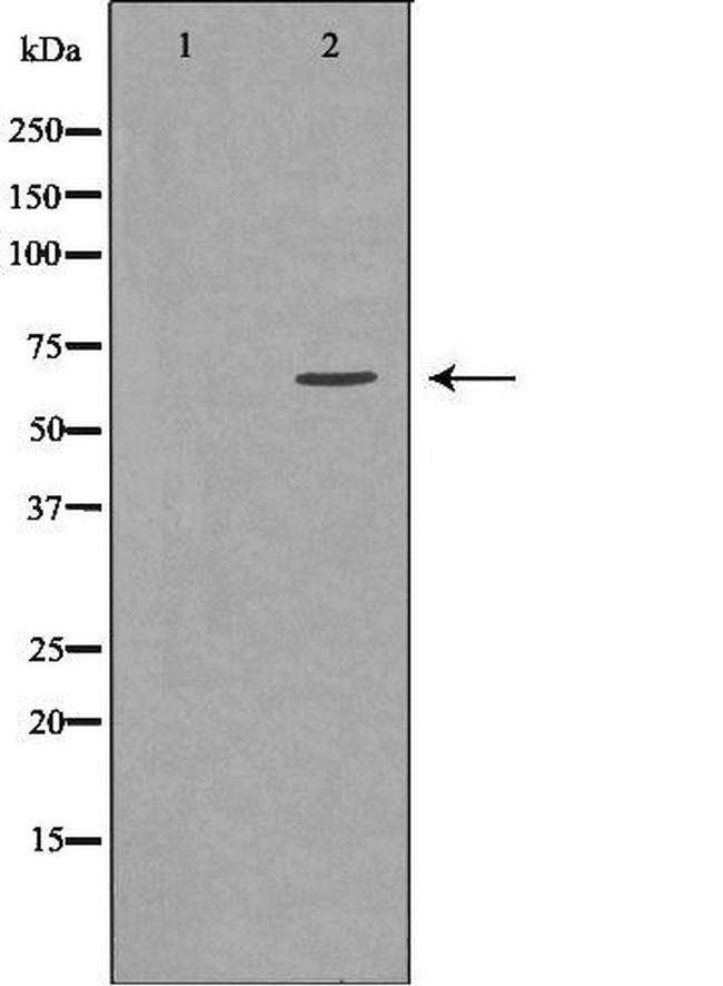 GGA2 Antibody in Western Blot (WB)