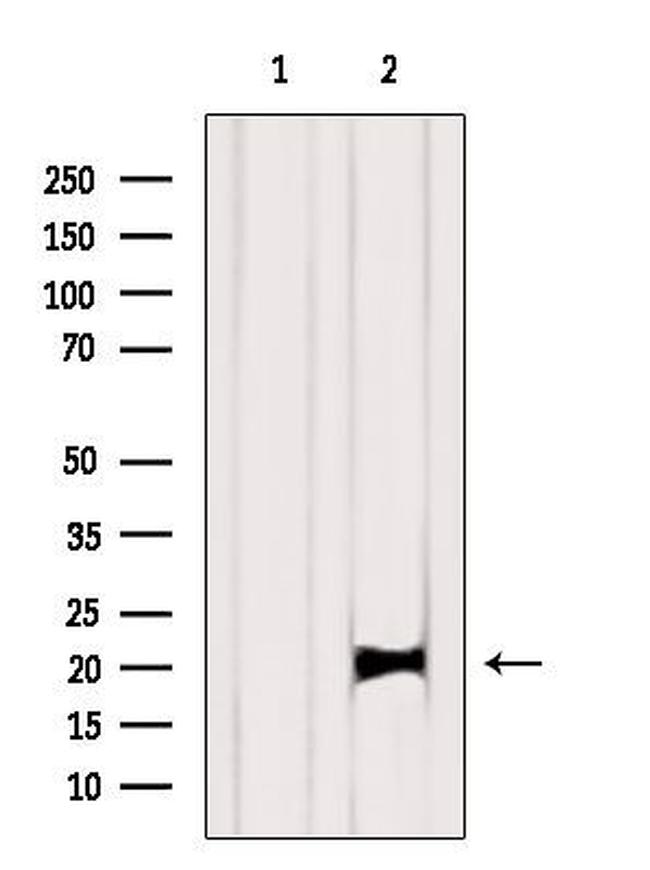 K-Ras Antibody in Western Blot (WB)