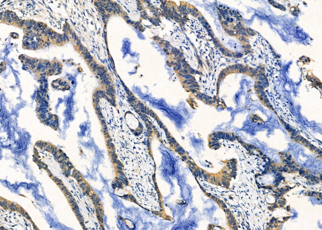 SCRN2 Antibody in Immunohistochemistry (Paraffin) (IHC (P))