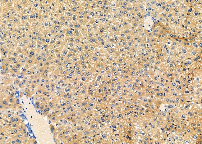 SCRN2 Antibody in Immunohistochemistry (Paraffin) (IHC (P))