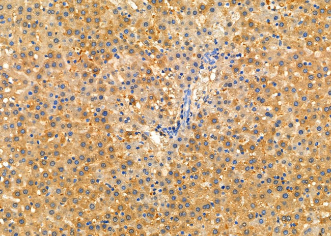 SCRN2 Antibody in Immunohistochemistry (Paraffin) (IHC (P))