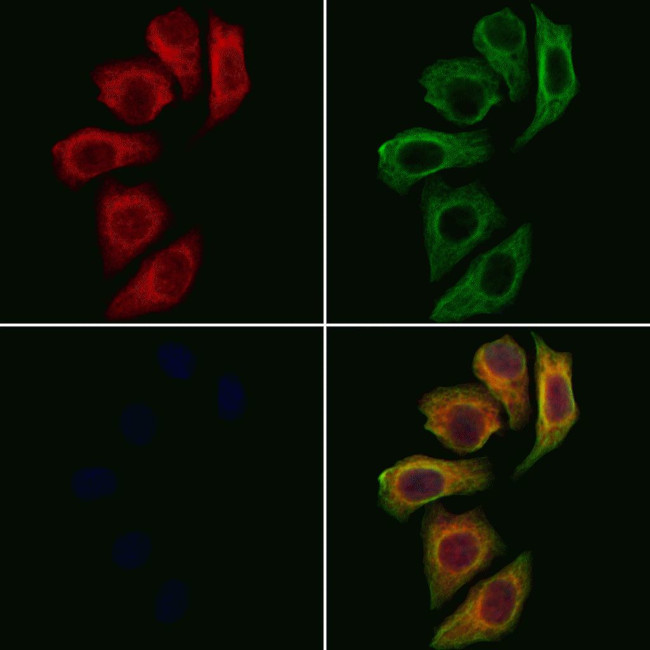 DEFB121 Antibody in Immunocytochemistry (ICC/IF)