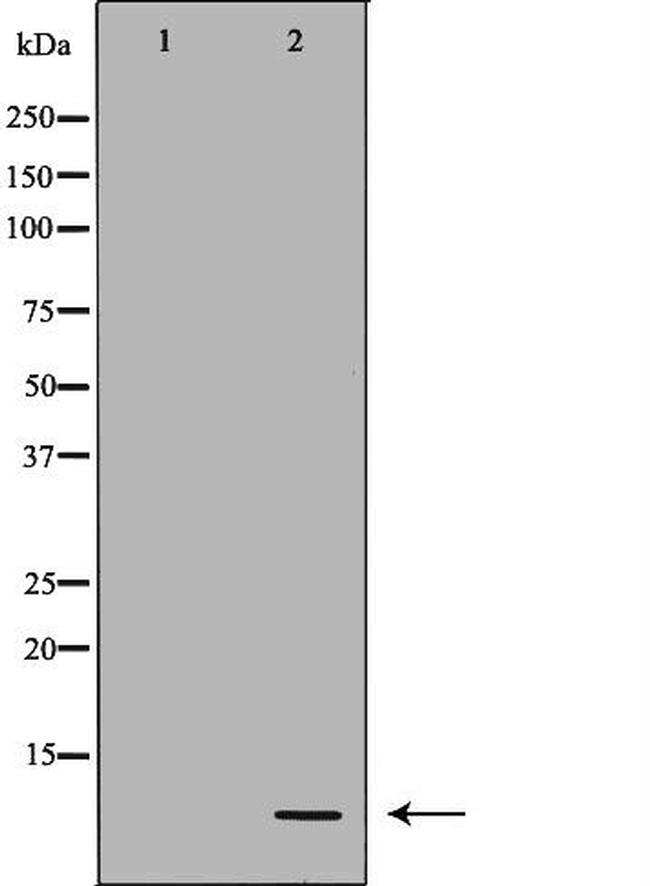 DEFB121 Antibody in Western Blot (WB)