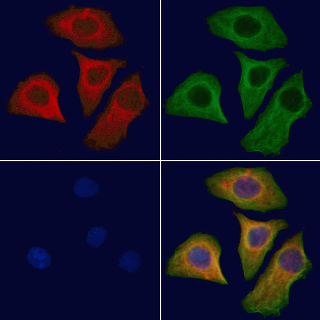 ATP6AP1 Antibody in Immunocytochemistry (ICC/IF)