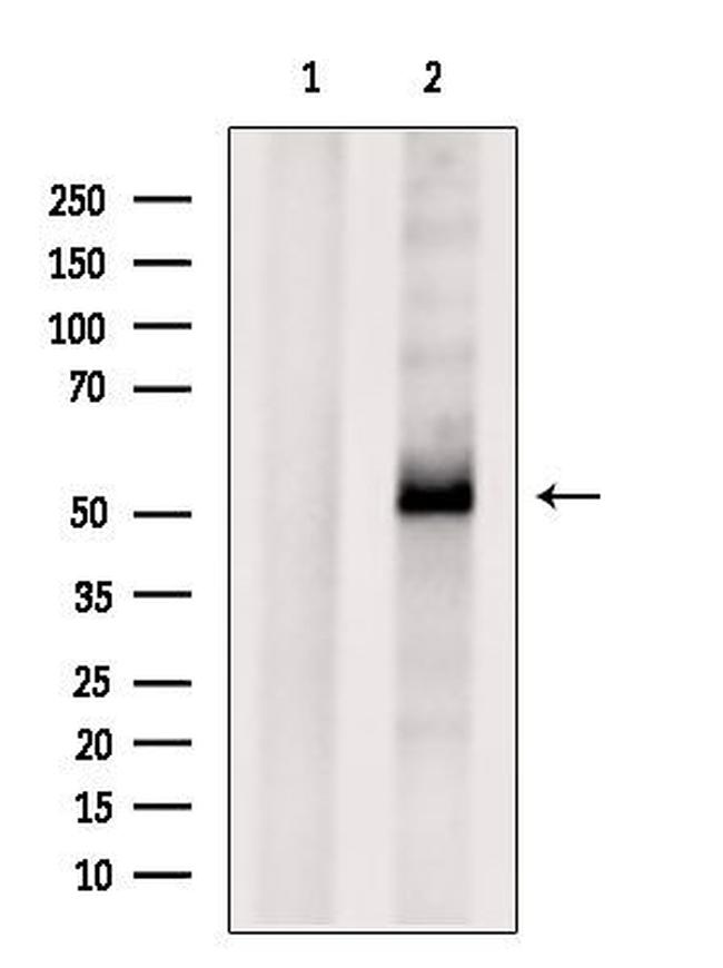 ATP6AP1 Antibody in Western Blot (WB)