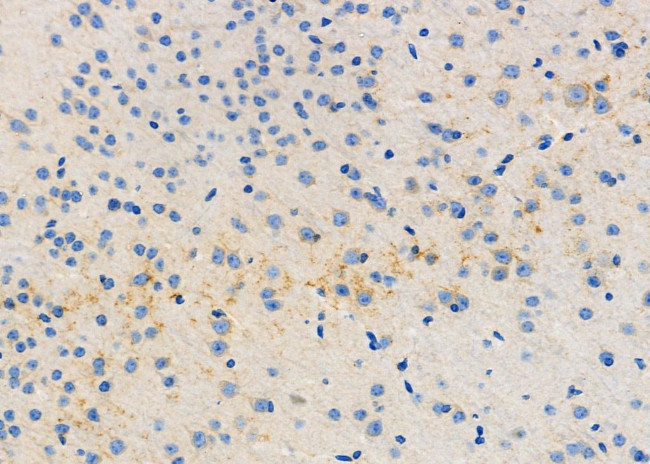 ITPA Antibody in Immunohistochemistry (Paraffin) (IHC (P))