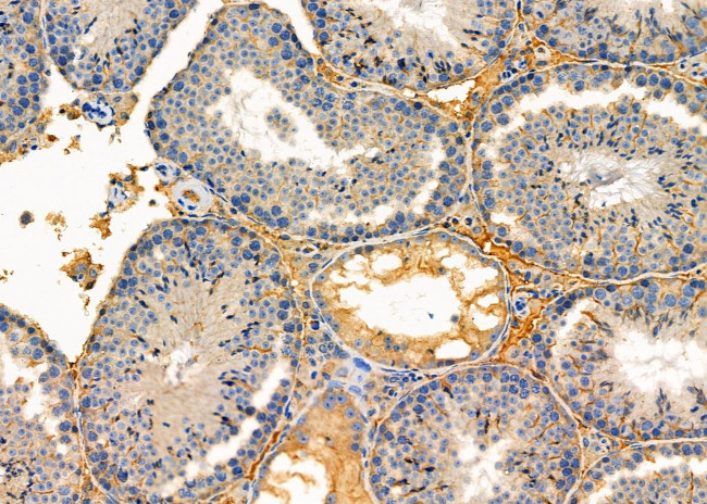 ITPA Antibody in Immunohistochemistry (Paraffin) (IHC (P))