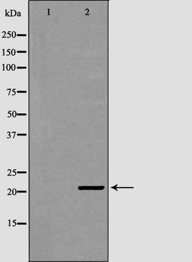 ITPA Antibody in Western Blot (WB)