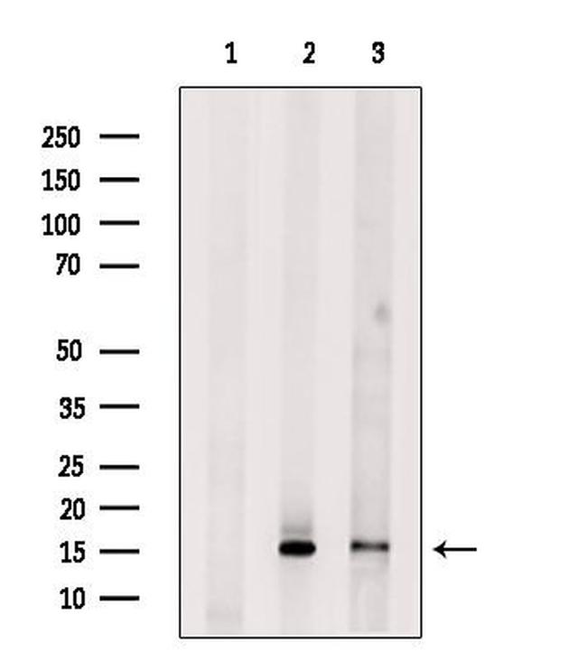 PLA2G2A Antibody in Western Blot (WB)