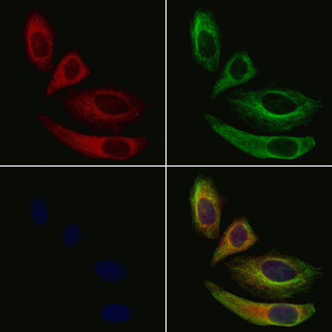 CD3d Antibody in Immunocytochemistry (ICC/IF)