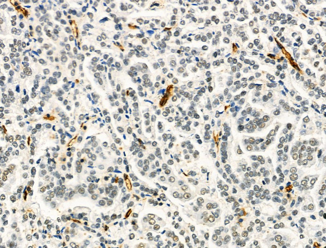 CD3d Antibody in Immunohistochemistry (Paraffin) (IHC (P))