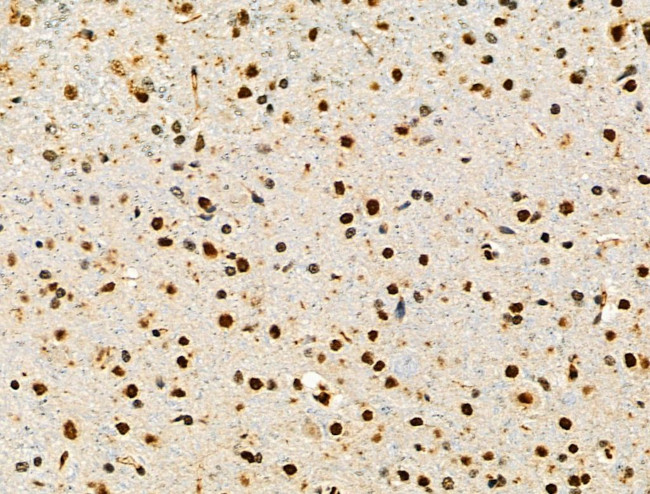 CD3d Antibody in Immunohistochemistry (Paraffin) (IHC (P))