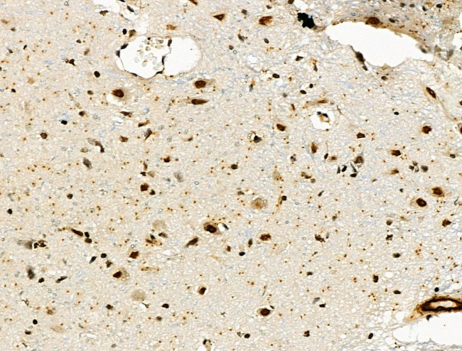 CD3d Antibody in Immunohistochemistry (Paraffin) (IHC (P))