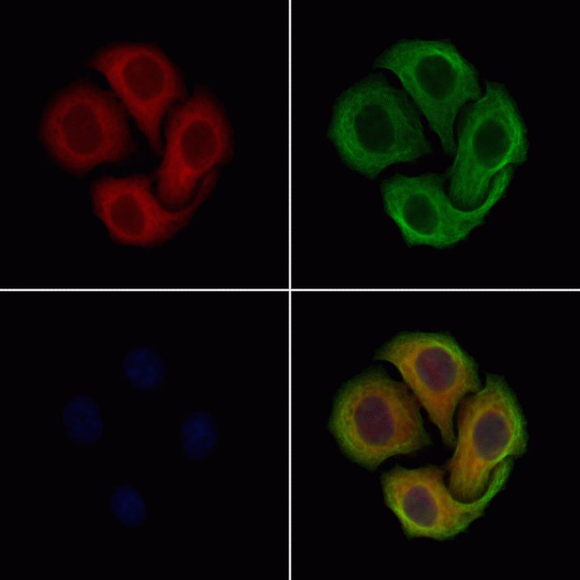 HFE Antibody in Immunocytochemistry (ICC/IF)