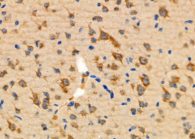 HFE Antibody in Immunohistochemistry (Paraffin) (IHC (P))