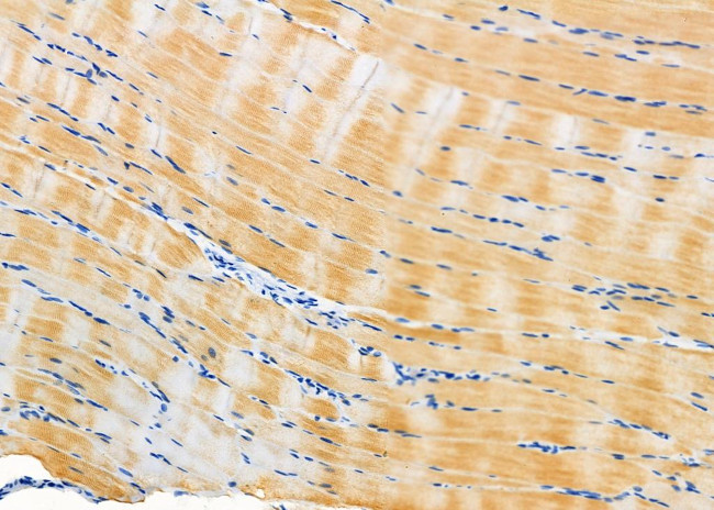 HFE Antibody in Immunohistochemistry (Paraffin) (IHC (P))