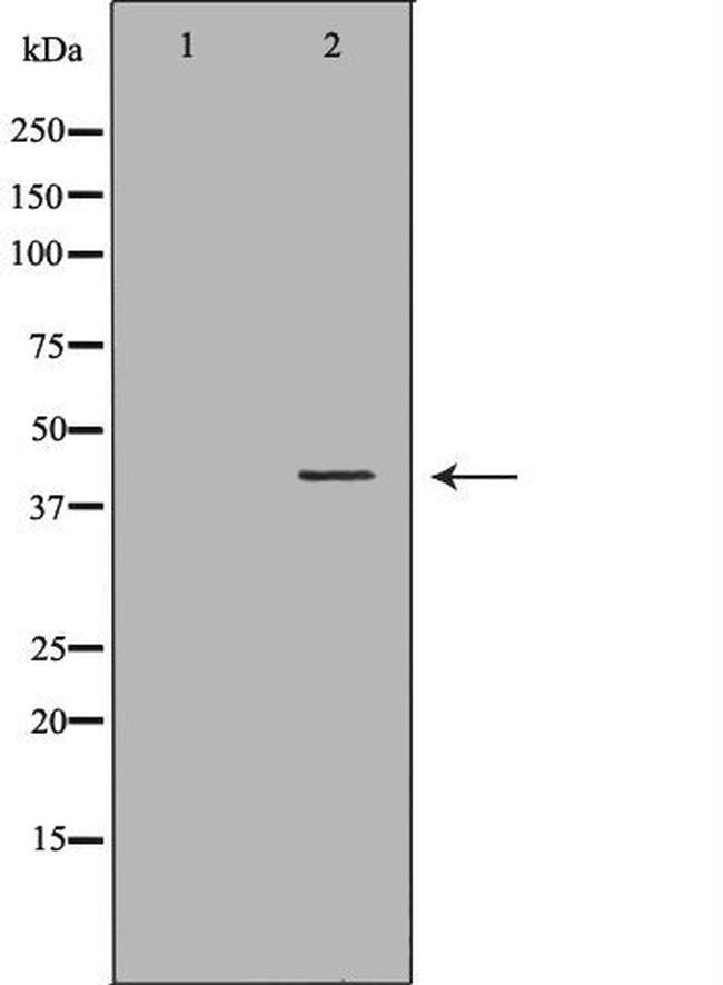 HFE Antibody in Western Blot (WB)