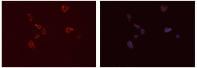 FCGR2A Antibody in Immunocytochemistry (ICC/IF)