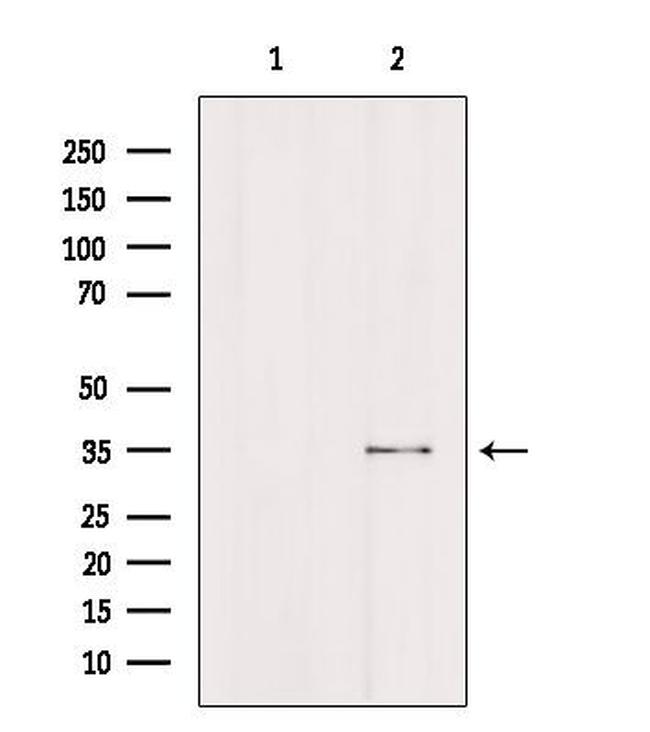 FCGR2A Antibody in Western Blot (WB)