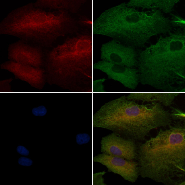 HLA-DR/DP Antibody in Immunocytochemistry (ICC/IF)