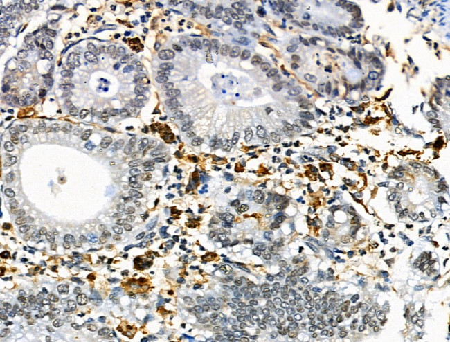 HLA-DR/DP Antibody in Immunohistochemistry (Paraffin) (IHC (P))