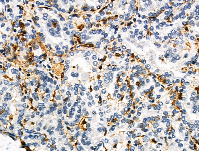 HLA-DR/DP Antibody in Immunohistochemistry (Paraffin) (IHC (P))