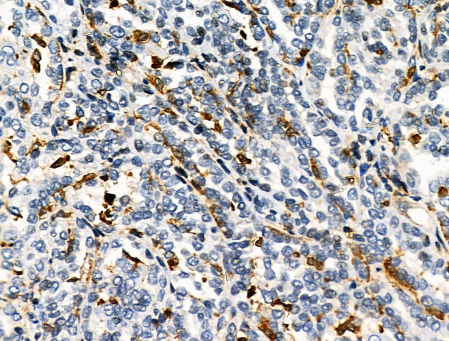 HLA-DR/DP Antibody in Immunohistochemistry (Paraffin) (IHC (P))