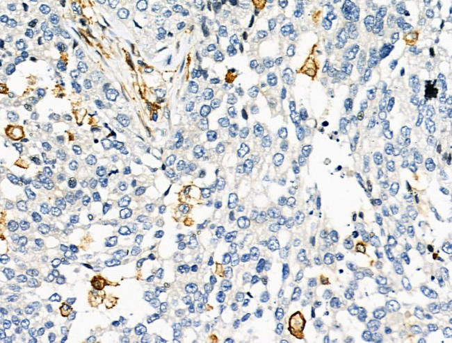 HLA-DR/DP Antibody in Immunohistochemistry (Paraffin) (IHC (P))