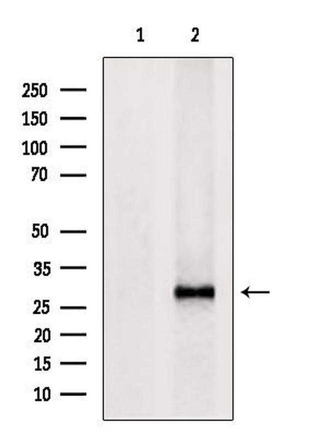 HLA-DR/DP Antibody in Western Blot (WB)