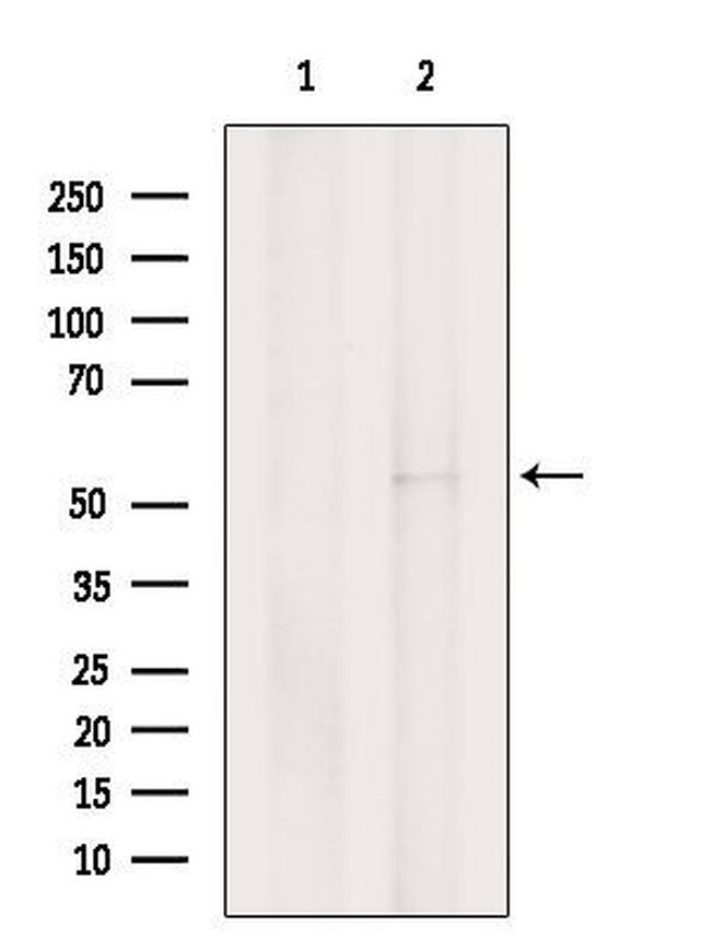 Factor X/Xa Antibody in Western Blot (WB)