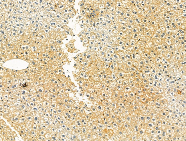 TLR8 Antibody in Immunohistochemistry (Paraffin) (IHC (P))