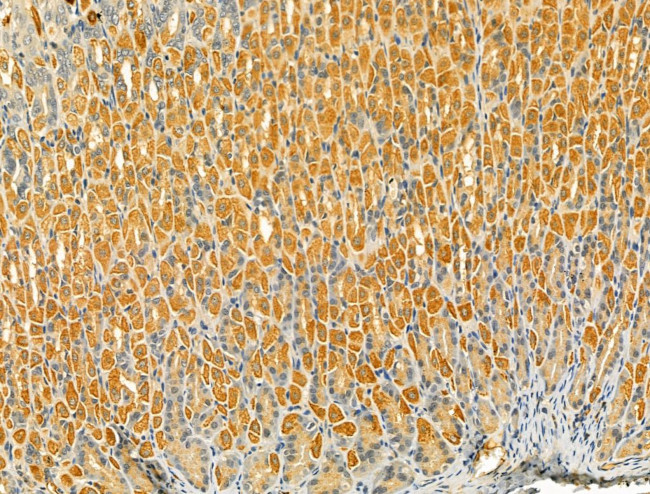 TLR8 Antibody in Immunohistochemistry (Paraffin) (IHC (P))