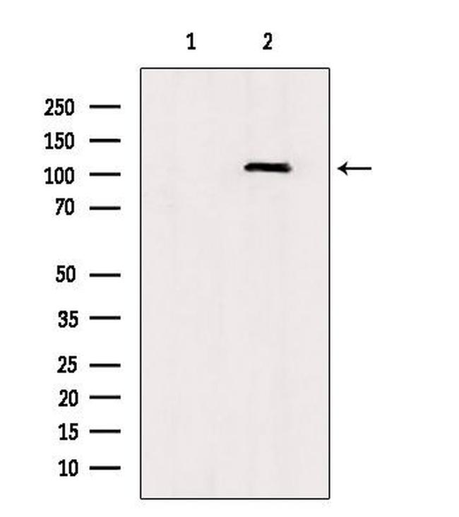 TLR8 Antibody in Western Blot (WB)