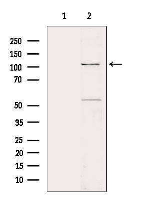 TLR8 Antibody in Western Blot (WB)