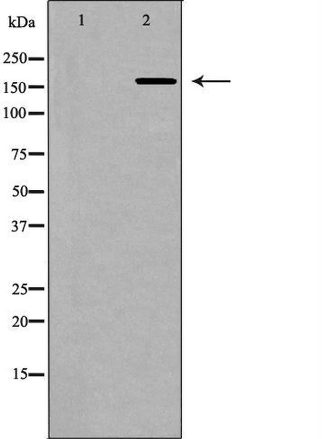 Collagen V Antibody in Western Blot (WB)