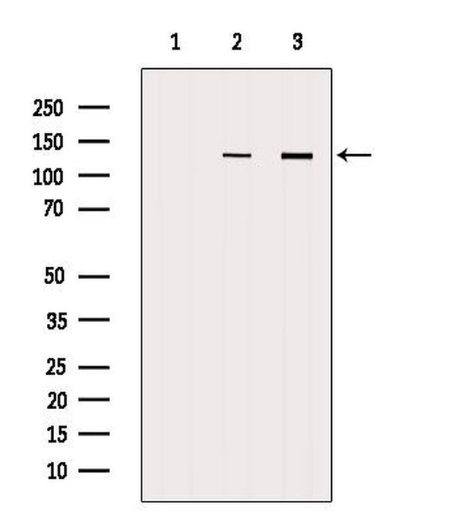 RENT1 Antibody in Western Blot (WB)