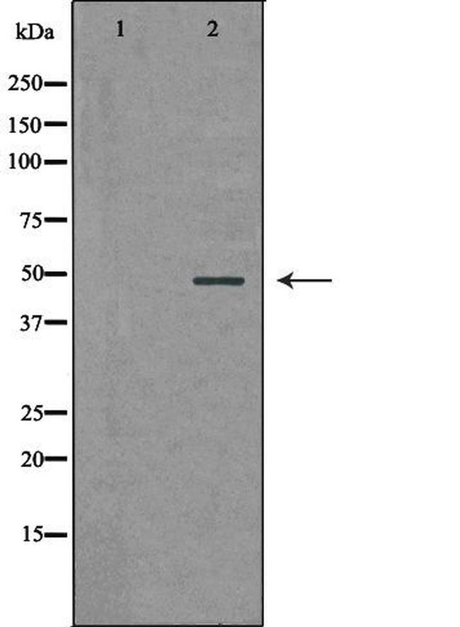 PSMC5 Antibody in Western Blot (WB)