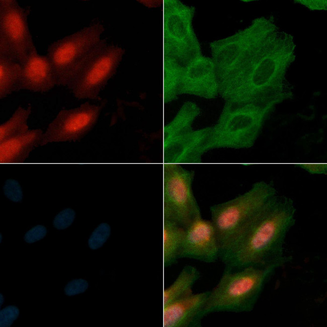 NFATC1 Antibody in Immunocytochemistry (ICC/IF)