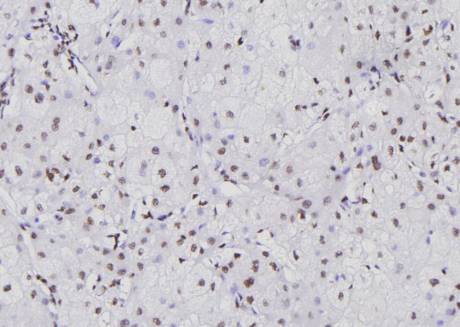 NFATC1 Antibody in Immunohistochemistry (Paraffin) (IHC (P))