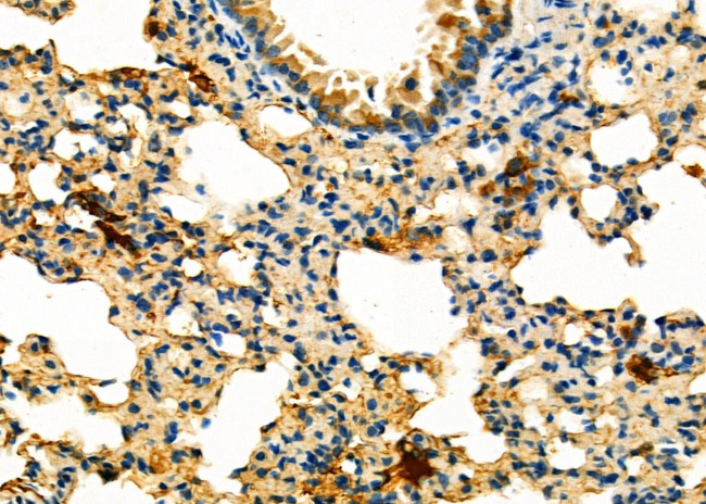 NAT1 Antibody in Immunohistochemistry (Paraffin) (IHC (P))