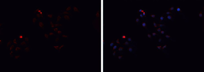 Haptoglobin Antibody in Immunocytochemistry (ICC/IF)