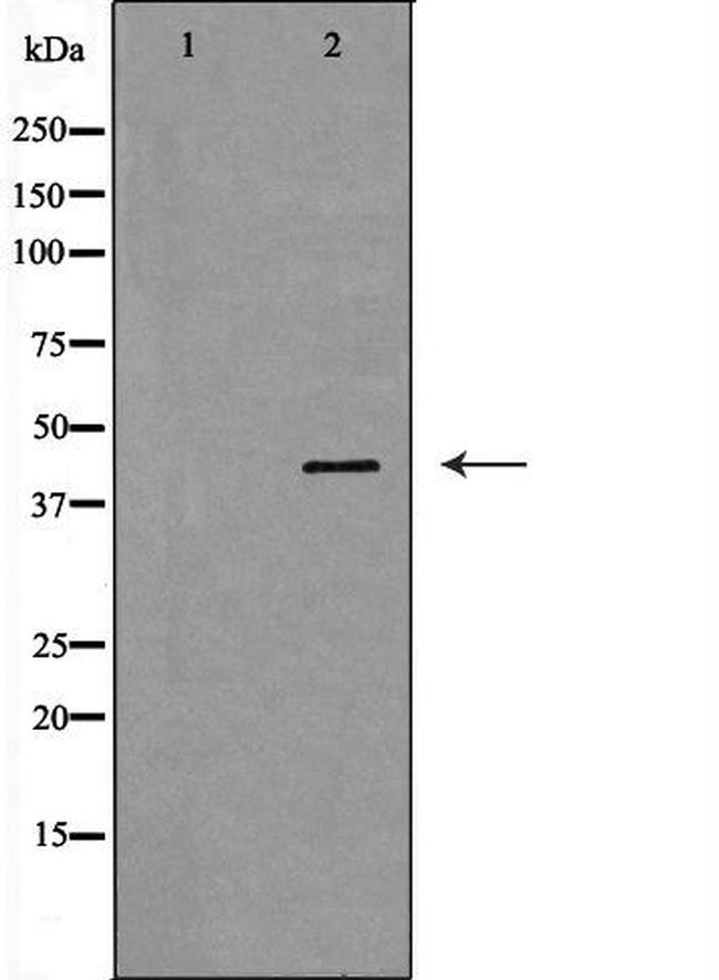 Haptoglobin Antibody in Western Blot (WB)