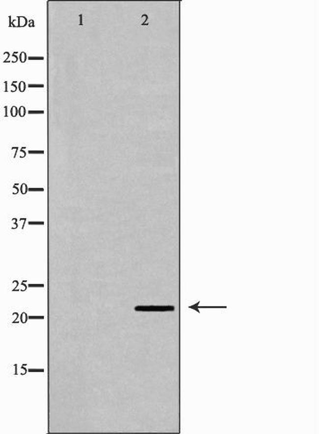 IFN beta Antibody in Western Blot (WB)